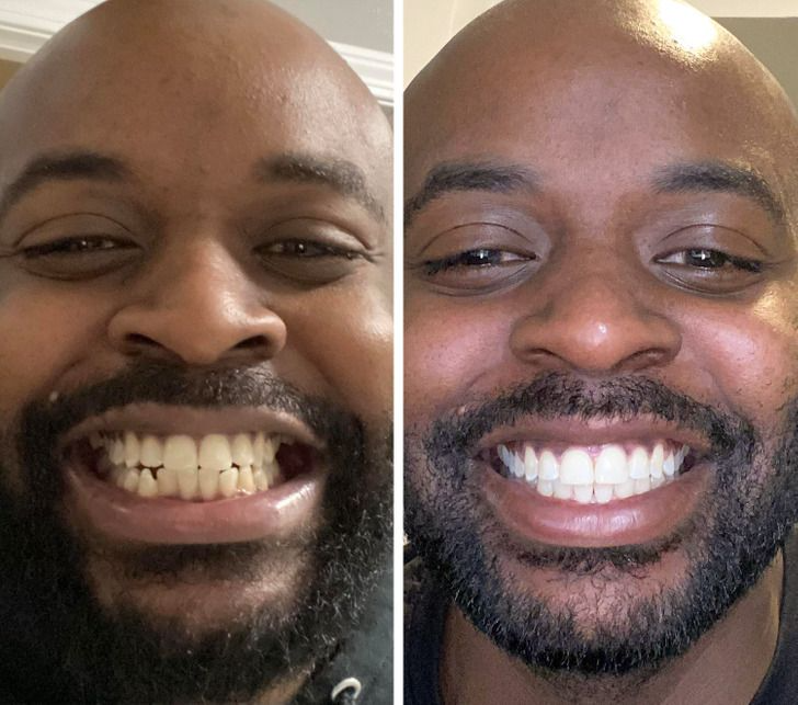 Dentifrice blanchissant